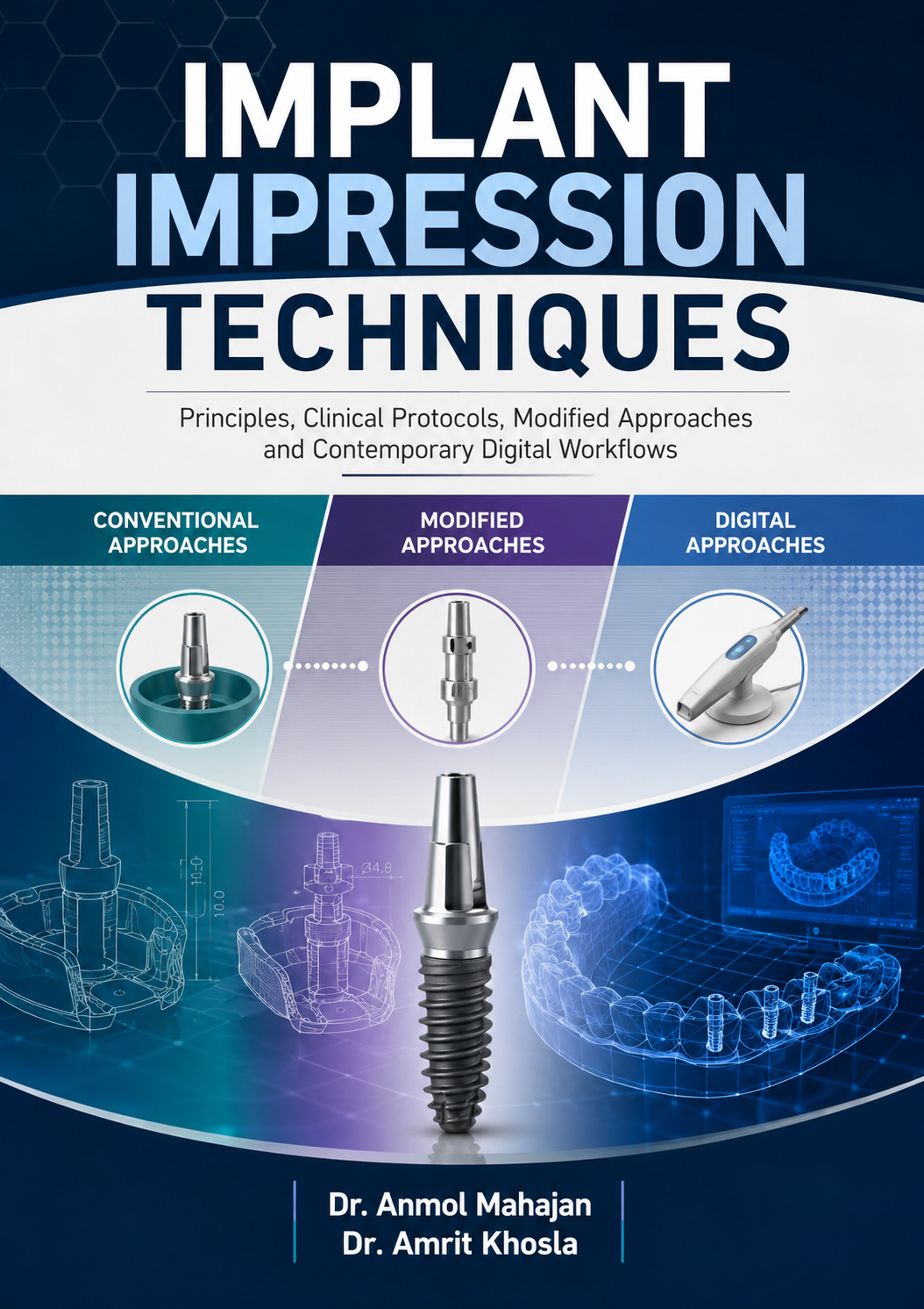 IMPLANT IMPRESSION TECHNIQUES Principles, Clinical Protocols, Modified Approaches and Contemporary Digital Workflows